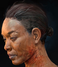 Angela scars