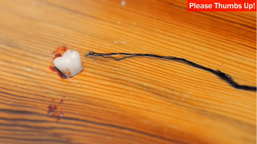 TOOTH RIPPED OUT! | JesseAndMike Wiki | Fandom