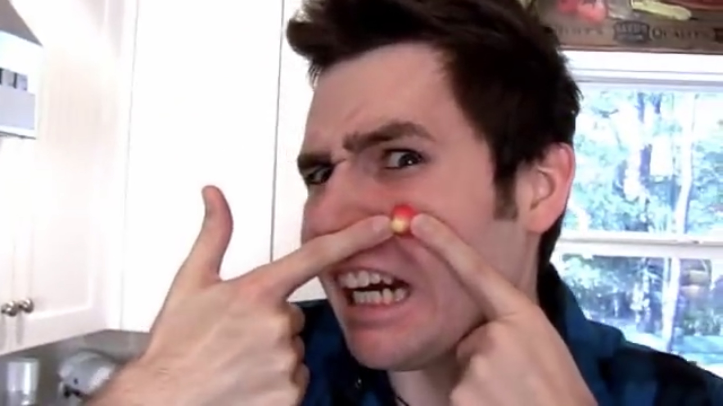 The Biggest Pimple You'Ve Ever Seen (Popped!) - yyknnmi