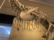 Shoulder region and arms; hands shown flexed beyond their ability to move in life
