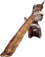 A  vertebrae injury fitting a Stegosaurus thagomizer.