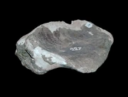 Coracoid