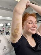 Bryce Dallas Howard bruise while filming