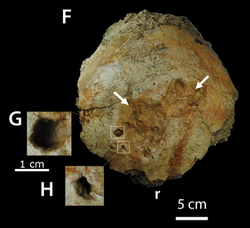 Pachycephalosaurus cranial lesion