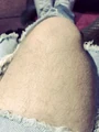 Justin Bieber's knee.jpg (386 KB)