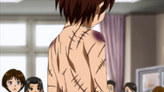 Masaru showing his scars