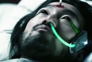 Fancy Lee undergoing Red 17 medical procedure