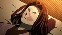 Kagaya's bandaged face