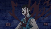 Injured shin