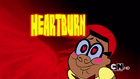 Heartburn