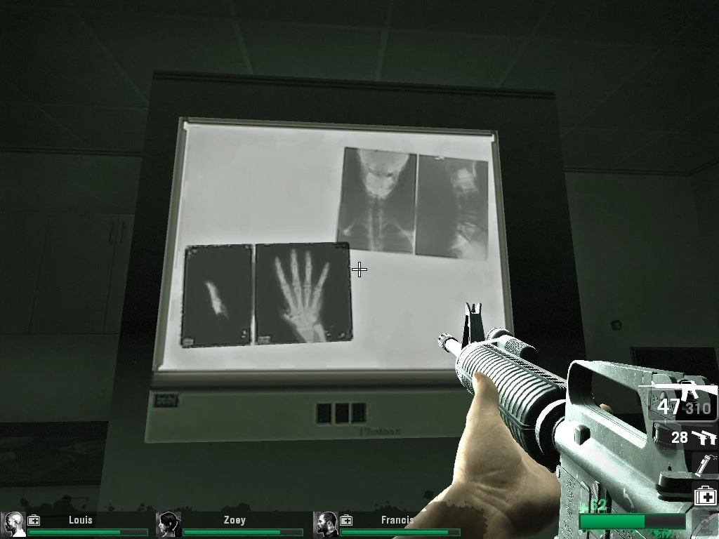 The Spitter | Left 4 Dead Wiki | Fandom