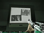 Una placa de rayos-X mostrando posiblemente el cuello de la Spitter (notese que la placa de al lado es una referencia al logo de L4D