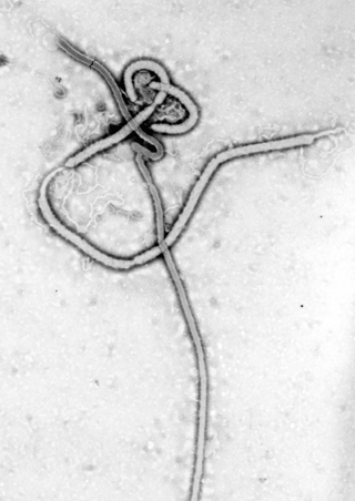 Ebola virus em