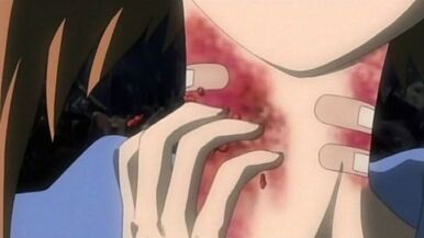 Maggots in the neck, the most common effect.