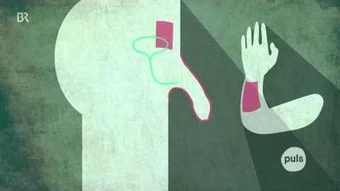 Geschlechtsangleichung-FtM-Op