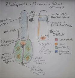 Phalloplastik Gefühl