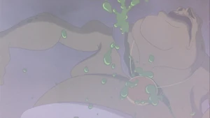 Scabies