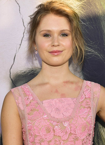 Eliza Scanlen, Little Women Wiki