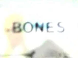 Bones (TV series)