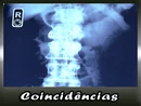 Coincidência