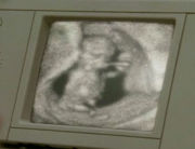 180px-Ultrasound