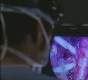  realizando su primera operación.