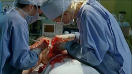 JulietSurgery 5x11