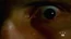 3x20eye