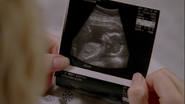 The date in Claire's sonogram shows a date of "10-22-2004" when it should be "09-22-2004"