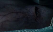 Morgul blade wound