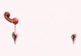 Crimson Kiss