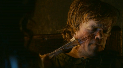 Tyrion Lannister Hurt