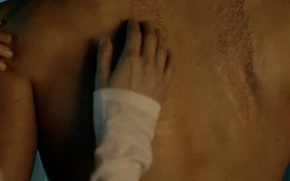  touches  scars on his back from when  cut  off.