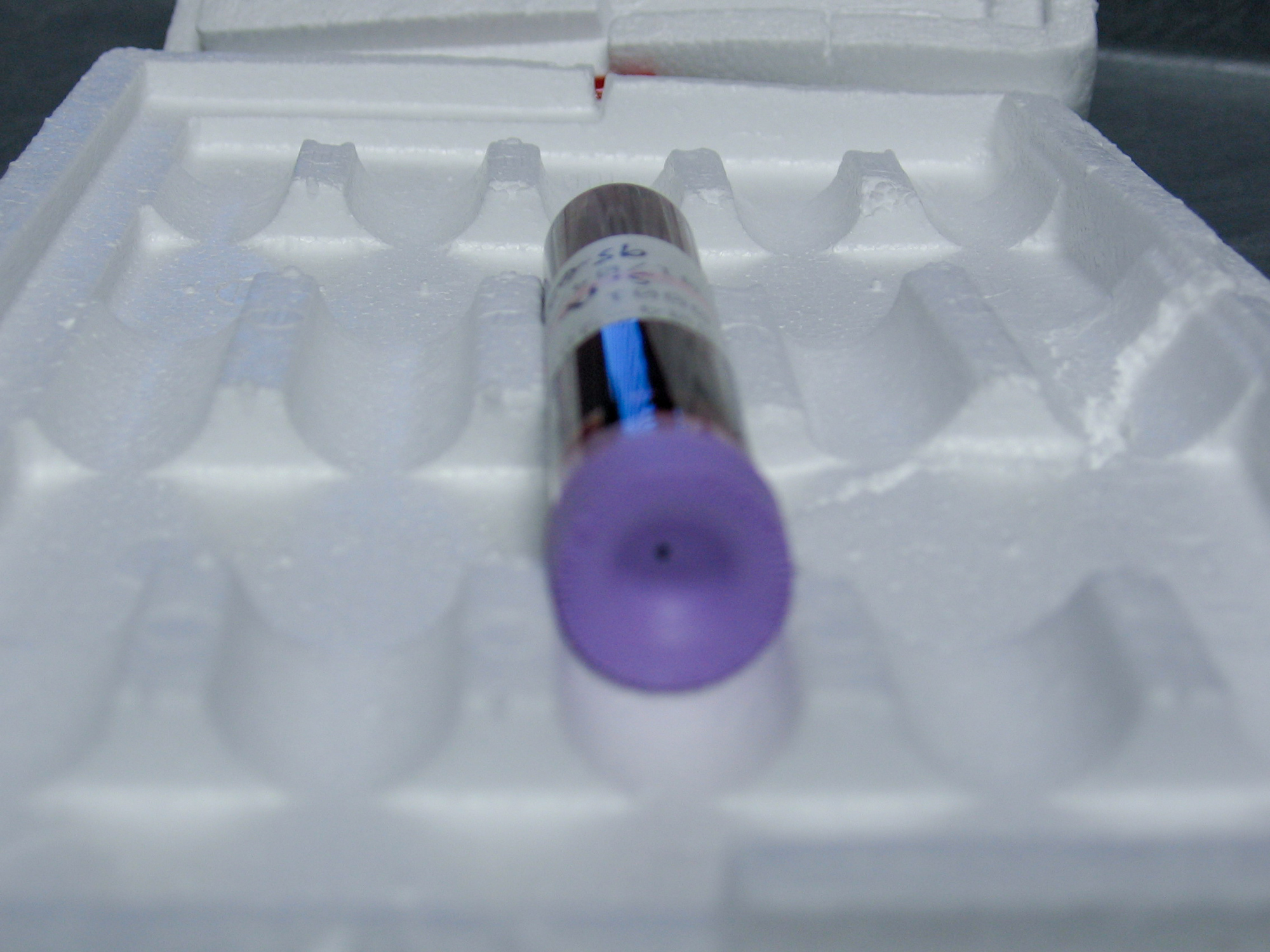 Vials Of Blood Drawn Genuine Rare www.gbutaganskij.ru