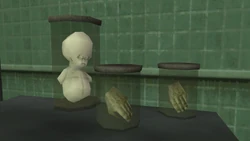 A human fetus with a deformed brain.