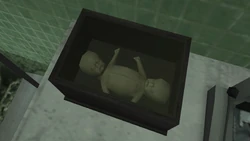 Two conjoined human fetuses.