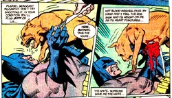 "Slaying a wild dog with a silver dagger"