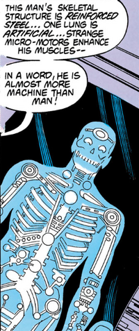 An x-ray showing Heywood's steel frame.