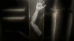 Like a lizard, Zeke severs his limbs to escape