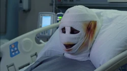 Перебинтованное лицо Руссо.