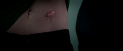 Nat's Scar