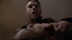 FitzRemovingSilencingImplant