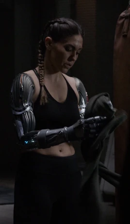 Prótesis de brazos de Elena Rodriguez