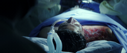 Joaquin Torres in surgery