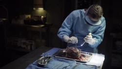 19-Simmons Remorath Autopsy