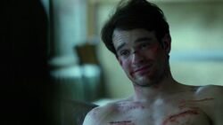 Matt-Murdock-Stitches-Smile