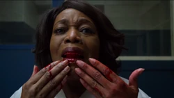 MDillardSpittingOutBlood