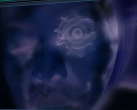 Backscatter X-Ray Eye Implant