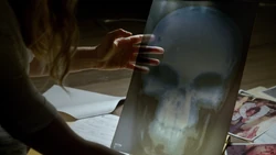 La radiographie du crâne de Castle montre sa blessure par balle