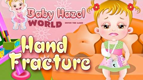 Baby Hazel Hand Fracture - Baby Hazel World